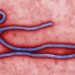 EBOLA Virus disease