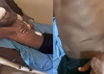 How CT Scan Ended Old Kampala Hospital Kidney Harvesting Saga