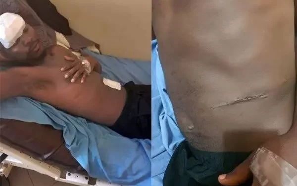 How CT Scan Ended Old Kampala Hospital Kidney Harvesting Saga